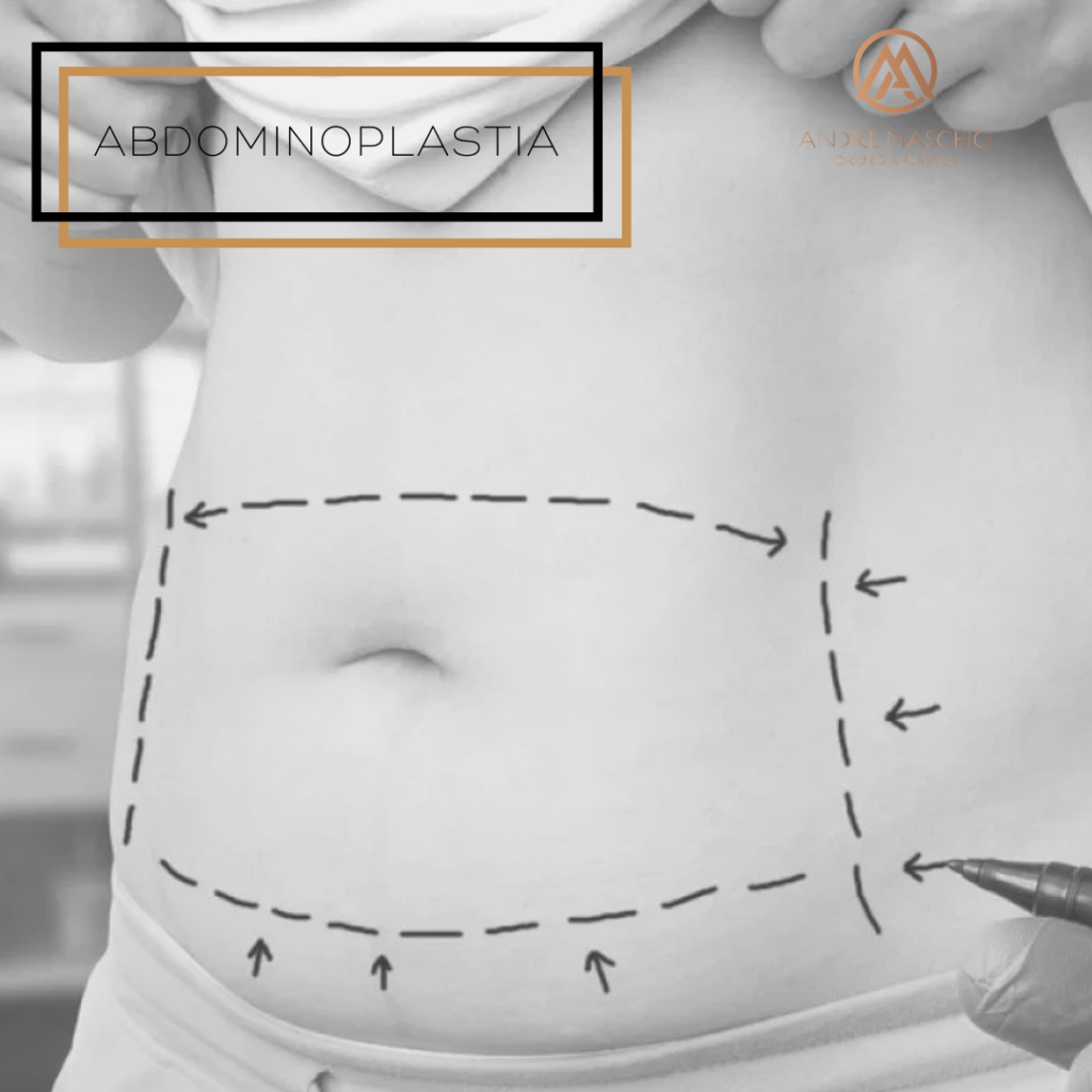 cirurgiao plastico curitiba Andre Maschio