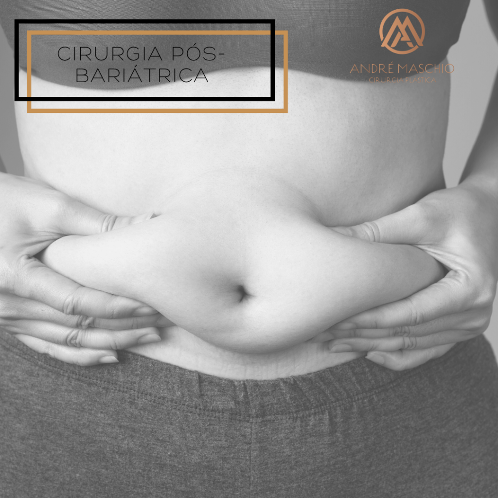 cirurgiao plastico curitiba Andre Maschio