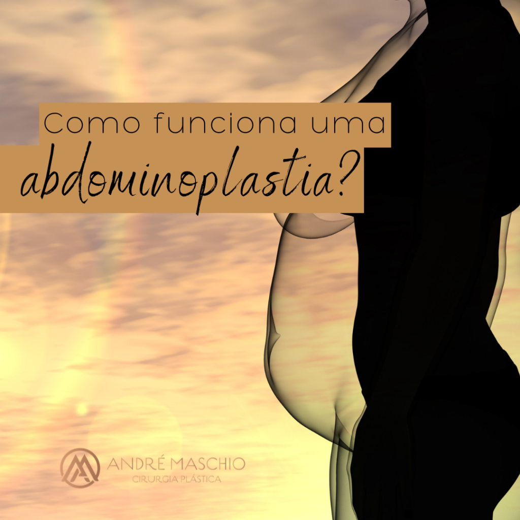 abdominoplastia