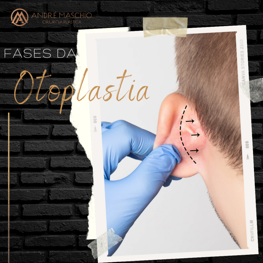 Procedimento na orelha