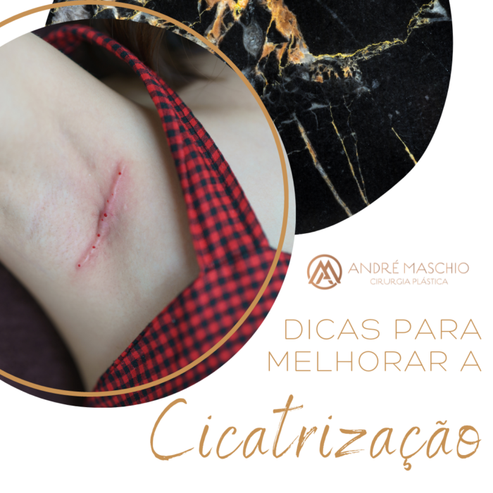 Cicatriz